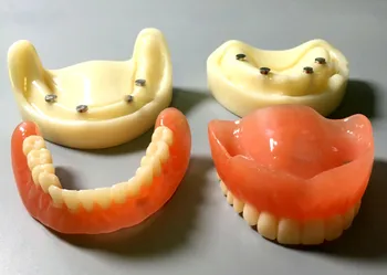 Stomatološki model potpune zubne proteze Overdenture Magnetski Nasadni Istraživanje vrhu donje čeljusti